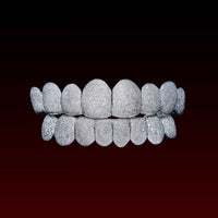 Diamond Dust Grillz